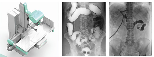 X射線檢查設(shè)備——數(shù)字DR